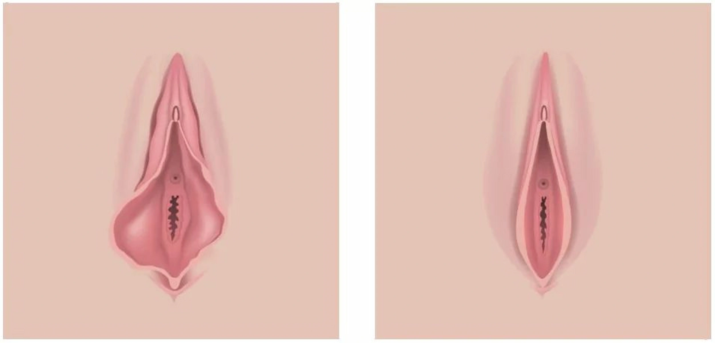 Ilustração médica educativa da anatomia externa da vulva e dos pequenos lábios
